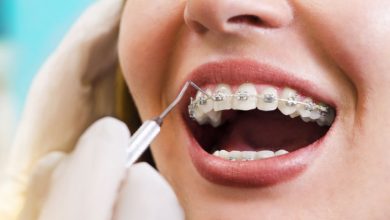 Photo of What is Orthodontic Treatment?